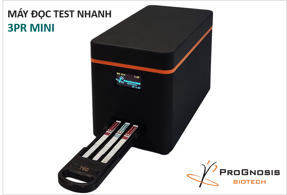 Hình 3: Máy đọc test nhanh 3PR Mini (NSX: ProGnosis Biotech)